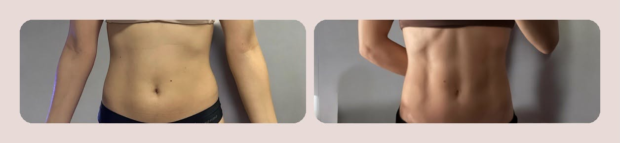 Tratamento para definição corporal